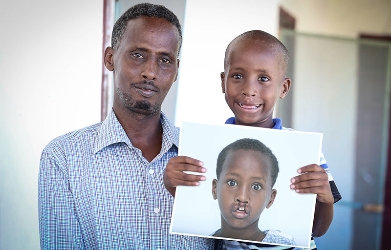 Shariif und sein Vater Mohammad lächeln und halten sein Vorher-Foto
